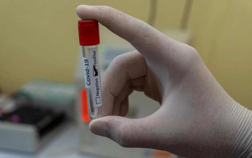 Galimybių pasui gauti galios tik PGR testas