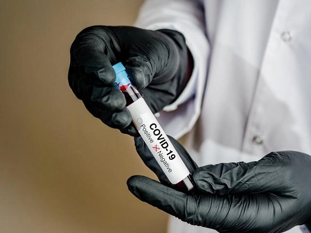Kovo 5-ąją Tauragėje nustatytas vienas COVID-19 susirgimas