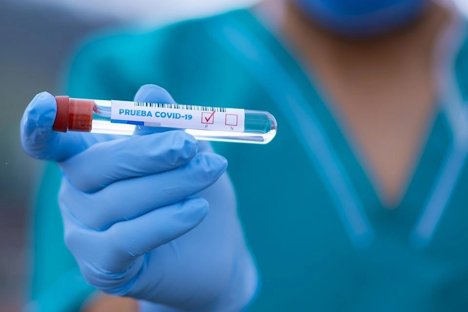 Praėjusią parą Tauragėje nustatytas 31 susirgimas